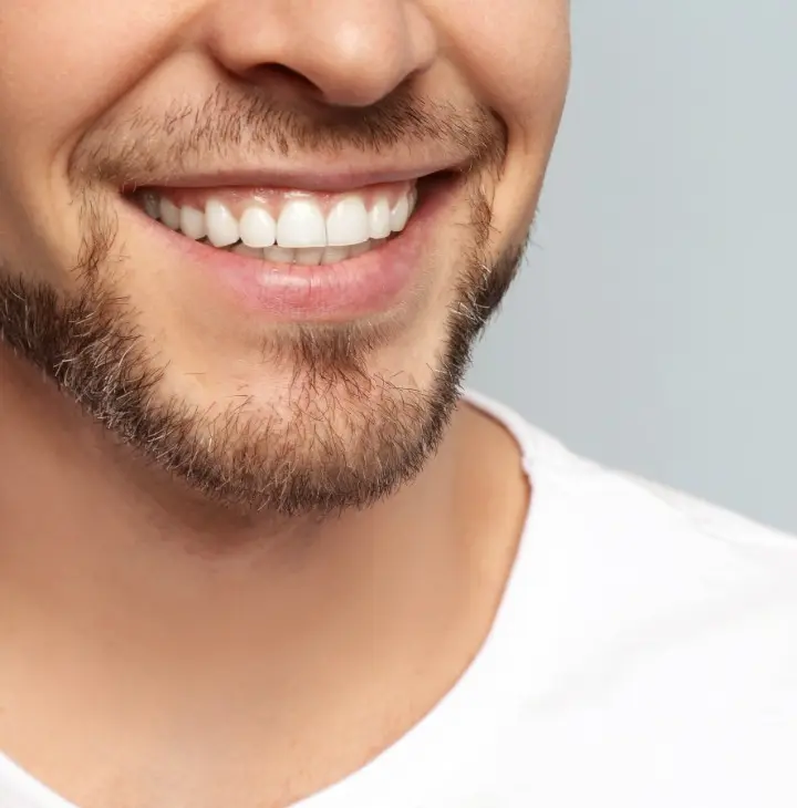 Invisalign vs Fixed Braces